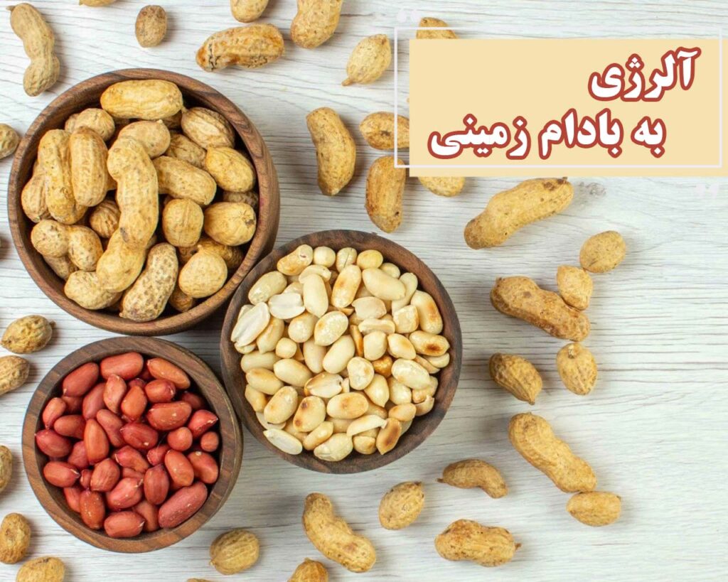 آلرژی به بادام زمینی