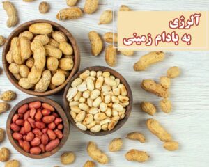 آلرژی به بادام زمینی